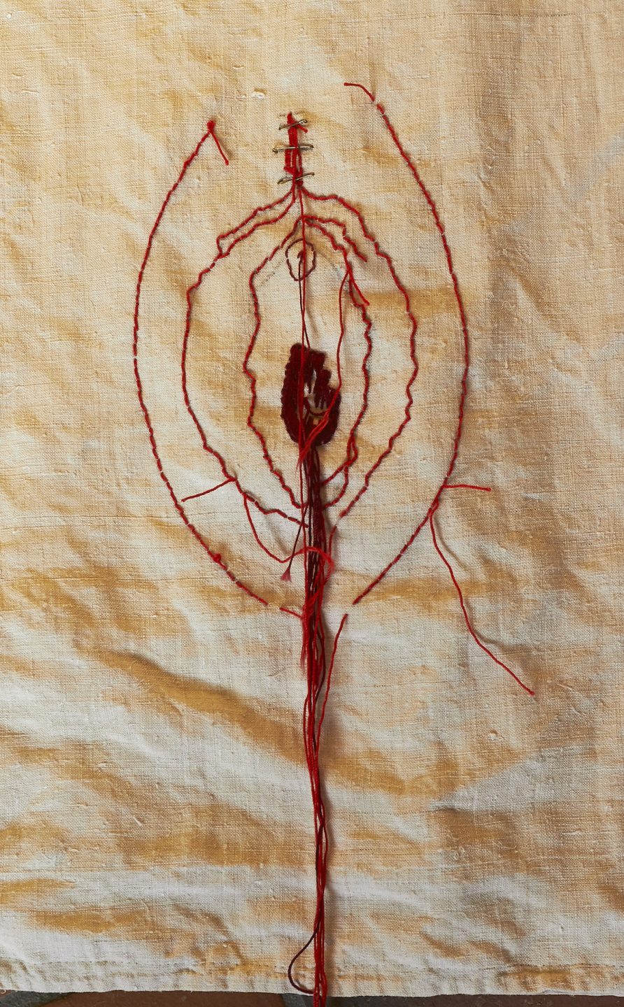 Sofie Vinet - Histoires de Femmes - EXcision - Robe 1 - détail