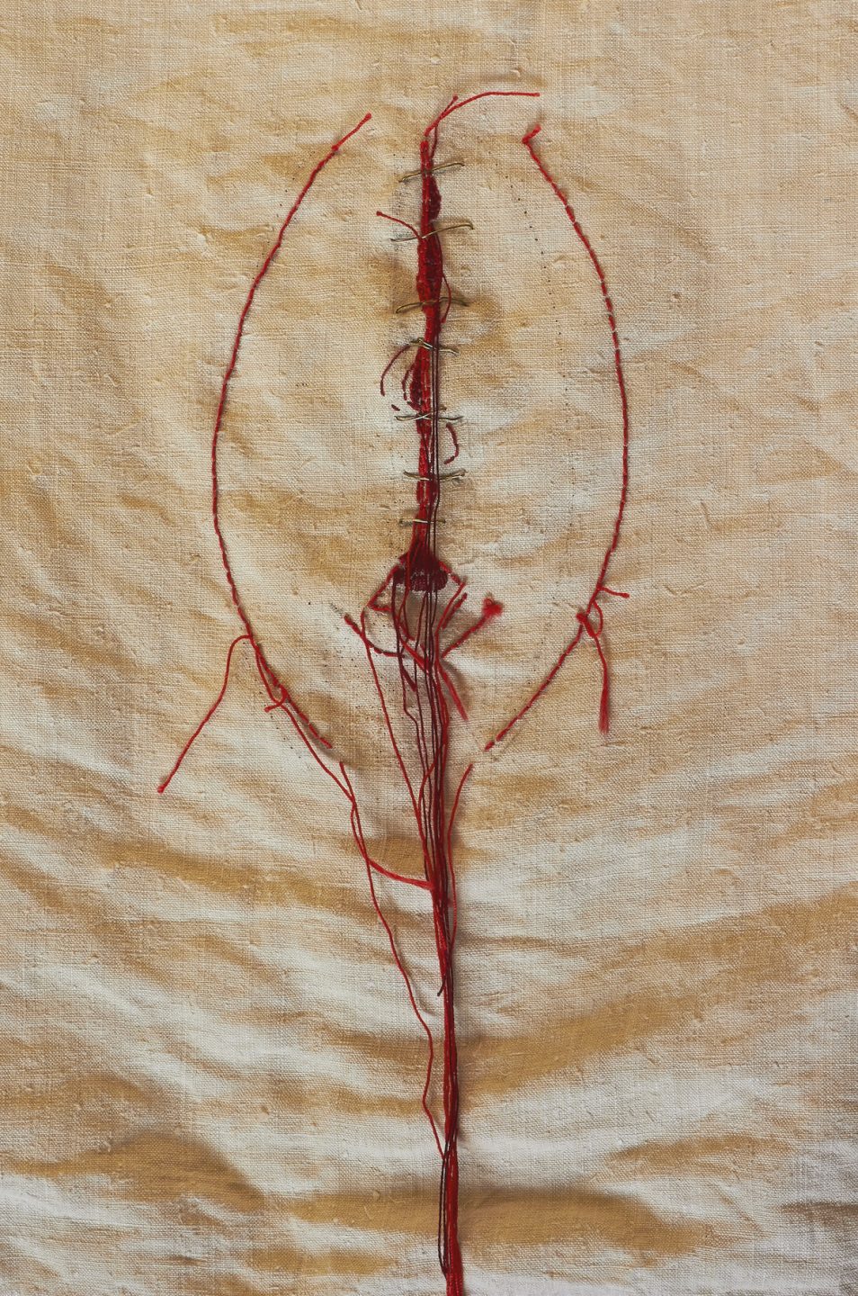 Sofie Vinet - Histoires de Femmes - EXcision - Robe 3 - détail - infibulation